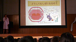 歯の集会